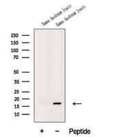 MIP2 / GRO2 / CXCL2 Antibody - Western blot analysis of extracts of human duodenum lysate using CXCL2 antibody. The lane on the left was treated with blocking peptide.