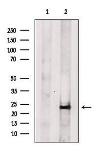 MIP2 / GRO2 / CXCL2 Antibody