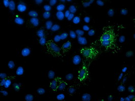 MIPEP Antibody - Anti-MIPEP mouse monoclonal antibody immunofluorescent staining of COS7 cells transiently transfected by pCMV6-ENTRY MIPEP.