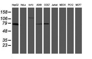 MIPEP Antibody - Western blot of extracts (35ug) from 9 different cell lines by using anti-MIPEP monoclonal antibody (HepG2: human; HeLa: human; SVT2: mouse; A549: human; COS7: monkey; Jurkat: human; MDCK: canine; PC12: rat; MCF7: human).