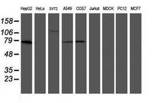 MIPEP Antibody - Western blot of extracts (35ug) from 9 different cell lines by using anti-MIPEP monoclonal antibody (HepG2: human; HeLa: human; SVT2: mouse; A549: human; COS7: monkey; Jurkat: human; MDCK: canine; PC12: rat; MCF7: human).