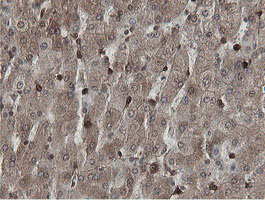 MIPEP Antibody - IHC of paraffin-embedded Human liver tissue using anti-MIPEP mouse monoclonal antibody.