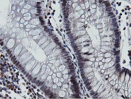 MIPEP Antibody - IHC of paraffin-embedded Human colon tissue using anti-MIPEP mouse monoclonal antibody.
