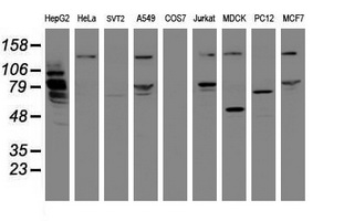 MIPEP Antibody - Western blot of extracts (35 ug) from 9 different cell lines by using anti-MIPEP monoclonal antibody (HepG2: human; HeLa: human; SVT2: mouse; A549: human; COS7: monkey; Jurkat: human; MDCK: canine; PC12: rat; MCF7: human).