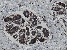 MIPEP Antibody - IHC of paraffin-embedded Human breast tissue using anti-MIPEP mouse monoclonal antibody.