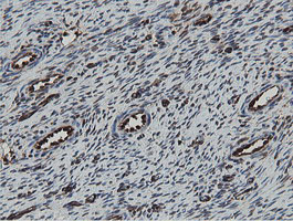MIPEP Antibody - IHC of paraffin-embedded Human Ovary tissue using anti-MIPEP mouse monoclonal antibody.