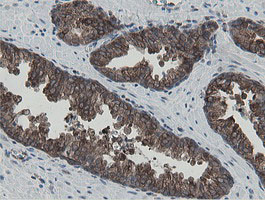 MIPEP Antibody - IHC of paraffin-embedded Human prostate tissue using anti-MIPEP mouse monoclonal antibody.