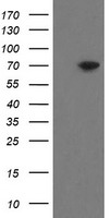 MIPEP Antibody - HEK293T cells were transfected with the pCMV6-ENTRY control (Left lane) or pCMV6-ENTRY MIPEP (Right lane) cDNA for 48 hrs and lysed. Equivalent amounts of cell lysates (5 ug per lane) were separated by SDS-PAGE and immunoblotted with anti-MIPEP.