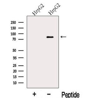 MIPEP Antibody - Western blot analysis of extracts of HepG2 cells using MIPEP antibody. The lane on the left was treated with blocking peptide.