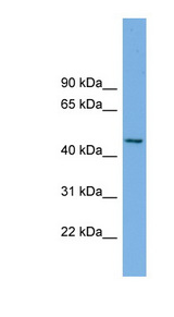 MIPOL1 Antibody - MIPOL1 antibody Western blot of ACHN lysate. This image was taken for the unconjugated form of this product. Other forms have not been tested.