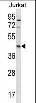 MIR16 / GDE1 Antibody - GDE1 Antibody western blot of Jurkat cell line lysates (35 ug/lane). The GDE1 antibody detected the GDE1 protein (arrow).