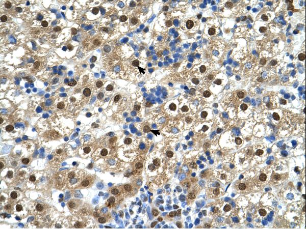 MIR16 / GDE1 Antibody - GDE1 / MIR16 antibody GDE1 Antibody was used in IHC to stain formalin-fixed, paraffin-embedded human liver.  This image was taken for the unconjugated form of this product. Other forms have not been tested.