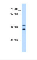 MIR16 / GDE1 Antibody - Jurkat cell lysate. Antibody concentration: 0.5 ug/ml. Gel concentration: 12%.  This image was taken for the unconjugated form of this product. Other forms have not been tested.