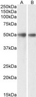 MIR16 / GDE1 Antibody - Goat Anti-GDE1 / MIR16 (aa230-242) Antibody (0.3µg/ml) staining of Mouse (A) and Rat (B) Brain lysates (35µg protein in RIPA buffer). Primary incubation was 1 hour. Detected by chemiluminescencence.