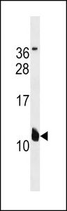 MIRP1 / KCNE2 Antibody - KCNE2 Antibody western blot of A549 cell line lysates (35 ug/lane). The KCNE2 antibody detected the KCNE2 protein (arrow).