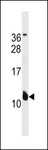 MIRP1 / KCNE2 Antibody - KCNE2 Antibody western blot of A549 cell line lysates (35 ug/lane). The KCNE2 antibody detected the KCNE2 protein (arrow).