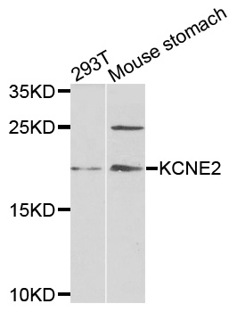 MIRP1 / KCNE2 Antibody - Western blot analysis of extracts of various cells.