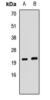 MIRP1 / KCNE2 Antibody