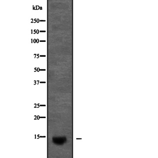 MIRP1 / KCNE2 Antibody - Western blot analysis of KCNE2 expression in Pancreas (mouse) tissue Lysate. The lane on the left is treated with the antigen-specific peptide.