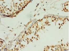 MIS12 Antibody - Immunohistochemistry of paraffin-embedded human testis using antibody at 1:100 dilution.  This image was taken for the unconjugated form of this product. Other forms have not been tested.