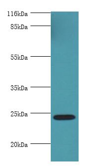 MIS12 Antibody - Western blot. All lanes: MIS12 antibody at 2 ug/ml+HeLa whole cell lysate. Secondary antibody: Goat polyclonal to rabbit at 1:10000 dilution. Predicted band size: 24 kDa. Observed band size: 24 kDa.  This image was taken for the unconjugated form of this product. Other forms have not been tested.