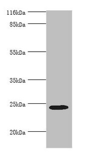 MIS12 Antibody - Western blot All lanes: MIS12 antibody at 2µg/ml + Hela whole cell lysate Secondary Goat polyclonal to rabbit IgG at 1/10000 dilution Predicted band size: 25 kDa Observed band size: 25 kDa