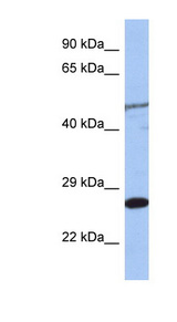 MIS12 Antibody - MIS12 antibody Western blot of Jurkat lysate. This image was taken for the unconjugated form of this product. Other forms have not been tested.