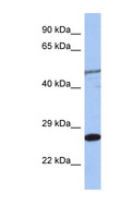 MIS12 Antibody - MIS12 antibody Western blot of Jurkat lysate. This image was taken for the unconjugated form of this product. Other forms have not been tested.