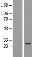 MIS12 Protein - Western validation with an anti-DDK antibody * L: Control HEK293 lysate R: Over-expression lysate