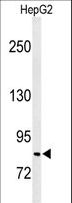 MISP / C19orf21 Antibody - Western blot of C19orf21 Antibody in HepG2 cell line lysates (35 ug/lane). C19orf21 (arrow) was detected using the purified antibody.