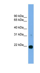 MITD1 Antibody - MITD1 antibody Western blot of MCF7 cell lysate. This image was taken for the unconjugated form of this product. Other forms have not been tested.