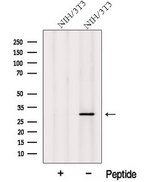 MITD1 Antibody - Western blot analysis of extracts of NIH-3T3 cells using MITD1 antibody. The lane on the left was treated with blocking peptide.
