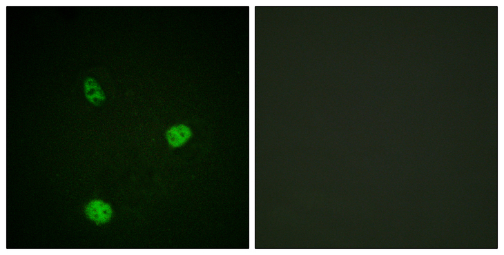 MITF Antibody - Immunofluorescence analysis of HeLa cells, using MITF Antibody. The picture on the right is blocked with the synthesized peptide.