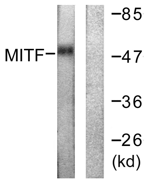 MITF Antibody - Western blot analysis of lysates from HepG2 cells, using MITF Antibody. The lane on the right is blocked with the synthesized peptide.