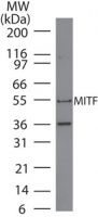 MITF Antibody - Western blot analysis of Mitf in A375 lysate using antibody at 4 ug/ml.