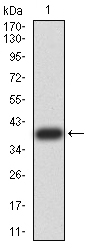 MITF Antibody - Western blot analysis using MITF mAb against human MITF (AA: 1-114) recombinant protein. (Expected MW is 38.9 kDa)