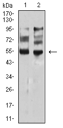 MITF Antibody - Western blot analysis using MITF mouse mAb against PANC-1 (1) and A549 (2) cell lysate.
