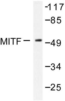MITF Antibody - Western blot of MITF (G174) pAb in extracts from COS7 cells.