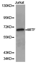MITF Antibody - Western blot of Jurkat cell lysate using MITF antibody.