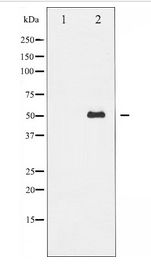 MITF Antibody - Western blot of MITF expression in HepG2 whole cell lysates,The lane on the left is treated with the antigen-specific peptide.