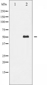MITF Antibody - Western blot analysis of MITF expression in HepG2 whole cells lysates. The lane on the left is treated with the antigen-specific peptide.
