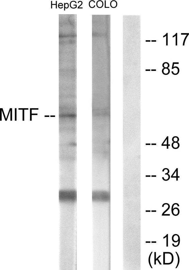 MITF Antibody - Western blot analysis of extracts from HepG2 cells (lane 1) and COLO205 cells (lane 2), using MITF (Ab-180/73) antibody.