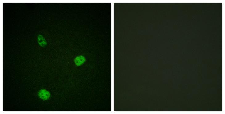 MITF Antibody - Peptide - + Immunofluorescence analysis of HeLa cells, using MITF (Ab-180/73) antibody.