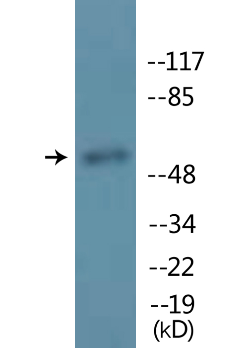 MITF Antibody - Western blot analysis of lysates from COS7 cells, using MITF (Phospho-Ser180/73) Antibody.