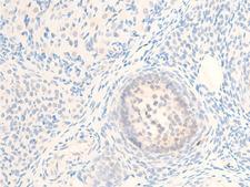 MITF Antibody - 1:100 staining rat ovarian tissue by IHC-P. The tissue was formaldehyde fixed and a heat mediated antigen retrieval step in citrate buffer was performed. The tissue was then blocked and incubated with the antibody for 1.5 hours at 22°C. An HRP conjugated goat anti-rabbit antibody was used as the secondary.
