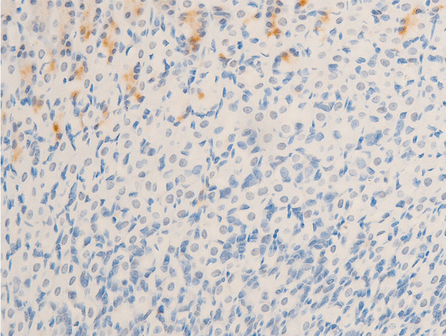 MITF Antibody - 1:100 staining mouse gastric tissue by IHC-P. The tissue was formaldehyde fixed and a heat mediated antigen retrieval step in citrate buffer was performed. The tissue was then blocked and incubated with the antibody for 1.5 hours at 22°C. An HRP conjugated goat anti-rabbit antibody was used as the secondary.