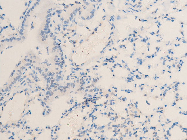 MITF Antibody - 1:100 staining mouse lung tissue by IHC-P. The tissue was formaldehyde fixed and a heat mediated antigen retrieval step in citrate buffer was performed. The tissue was then blocked and incubated with the antibody for 1.5 hours at 22°C. An HRP conjugated goat anti-rabbit antibody was used as the secondary.