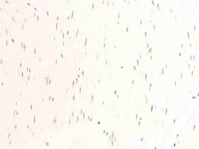MITF Antibody - 1:100 staining human heart tissue by IHC-P. The tissue was formaldehyde fixed and a heat mediated antigen retrieval step in citrate buffer was performed. The tissue was then blocked and incubated with the antibody for 1.5 hours at 22°C. An HRP conjugated goat anti-rabbit antibody was used as the secondary.