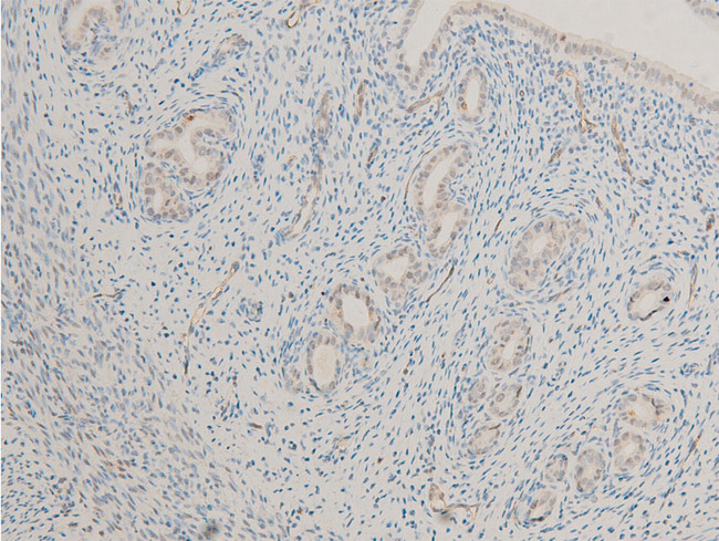 MITF Antibody - 1:100 staining rat uterine tissue by IHC-P. The tissue was formaldehyde fixed and a heat mediated antigen retrieval step in citrate buffer was performed. The tissue was then blocked and incubated with the antibody for 1.5 hours at 22°C. An HRP conjugated goat anti-rabbit antibody was used as the secondary.