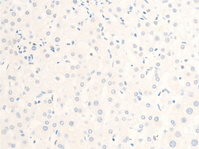 MITF Antibody - 1:100 staining human liver tissue by IHC-P. The tissue was formaldehyde fixed and a heat mediated antigen retrieval step in citrate buffer was performed. The tissue was then blocked and incubated with the antibody for 1.5 hours at 22°C. An HRP conjugated goat anti-rabbit antibody was used as the secondary.